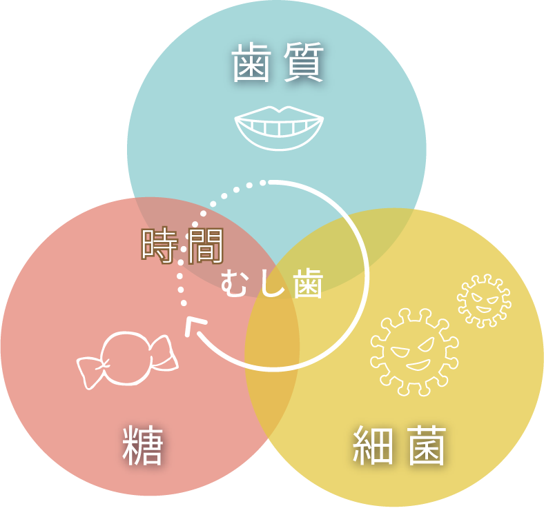 虫歯は歯質、細菌、糖に時間の経過が加わって発生する