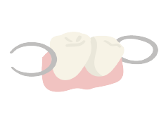 部分入れ歯