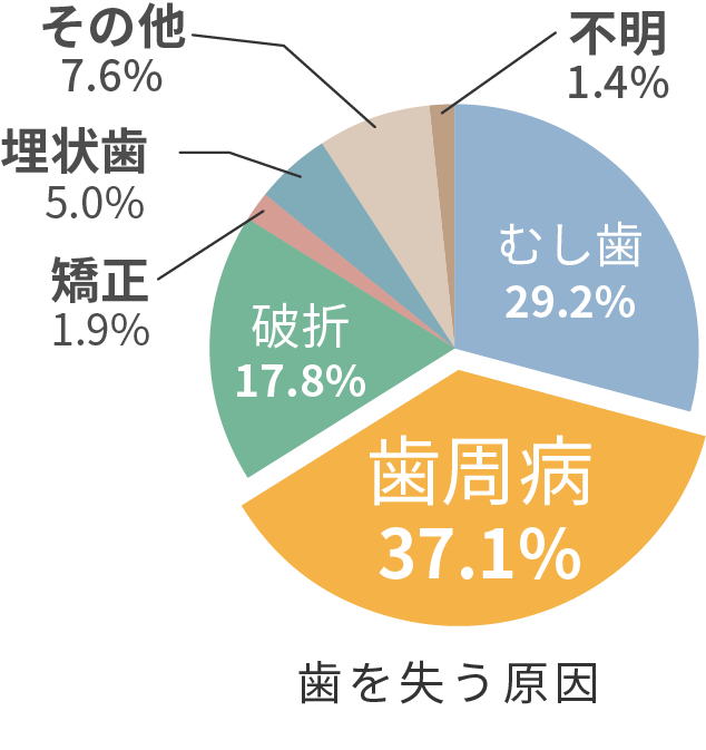 歯を失う原因 歯周病37.1%、虫歯29.2%、破折17.8%、埋伏歯5%、矯正1.9%、その他7.6%、不明1.4%